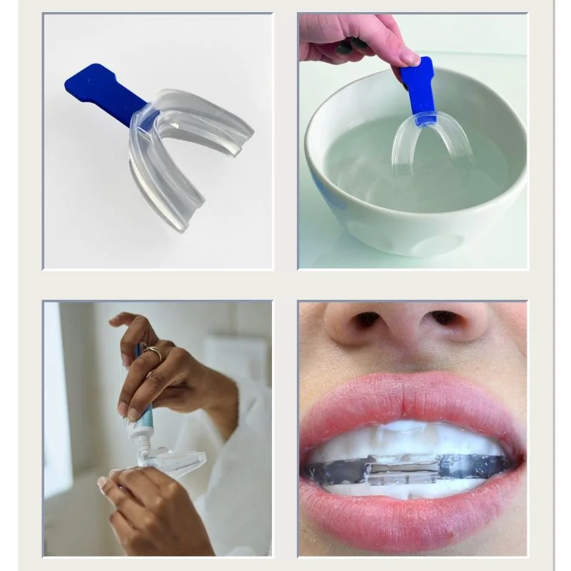 ApaCare Repair Dental Split 1szt. - termoformowalna szyna dentystyczna z pudełkiem do nakładania past odbudowujących - obrazek 2